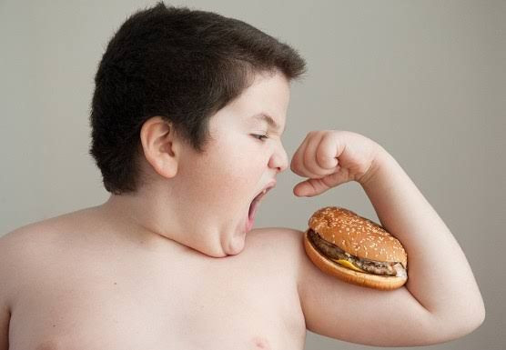 Anak obesitas