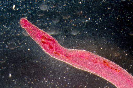 Cacing penyebab Schistosomiasis