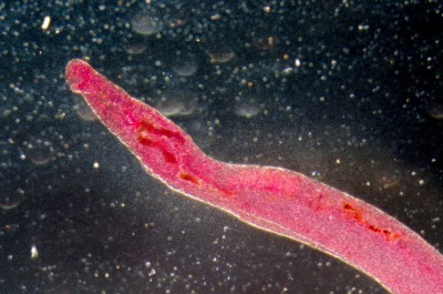 Mengenal Schistosomiasis, Gejala dan Pengobatannya