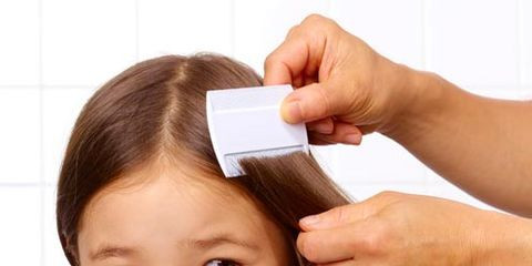 Cara Mengatasi Kutu Rambut Pada Anak