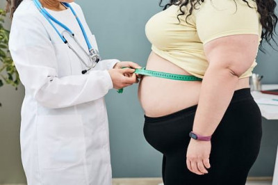 Studi: Obesitas Memengaruhi Gangguan Reproduksi Wanita