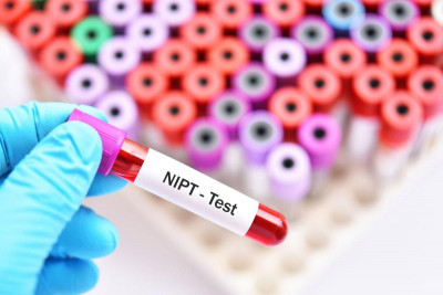 Kelainan Janin Bisa Dideteksi Dengan Metode NIPT