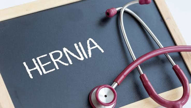 Penyebab Penyakit Hernia