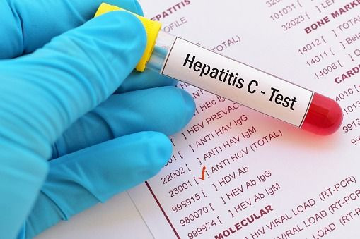 Tes hepatitis C