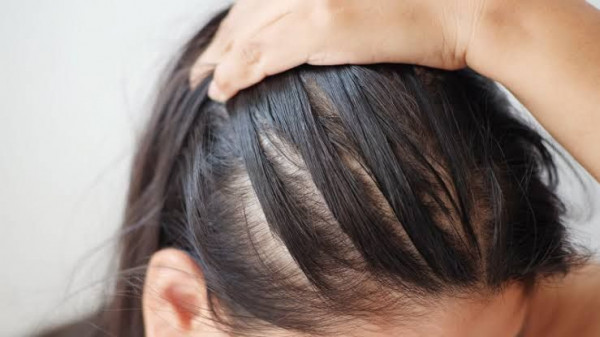 Penyebab Rambut Rontok Saat Menyusui