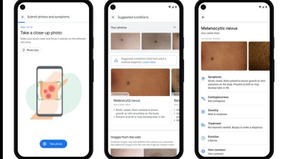 Google Bikin Alat Kecerdasan Buatan yang Bisa Identifikasi Kondisi Kulit
