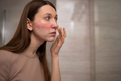 Kulit Sensitif Bikin Khawatir, Simak Tips Merawatnya! 