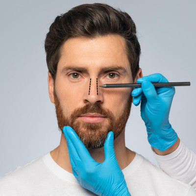 7 DAMPAK RHINOPLASTY, PERTIMBANGKAN LAGI YUK