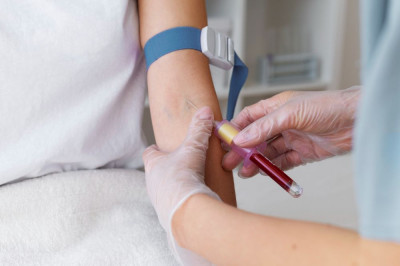 Mengapa Skrining Thalassemia Penting Sebelum Menikah dan Hamil?