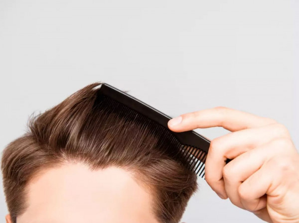 Berikut Beberapa Cara yang Bisa Dilakukan untuk Mencegah Rambut Rontok