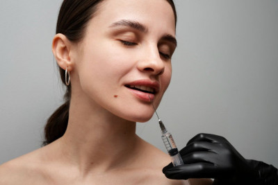 Bahaya Filler Bibir Bagi Kesehatan