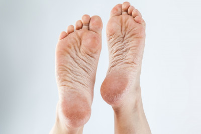 IKUTI 4 CARA INI! HEMPAS BAU KAKI MENYENGAT
