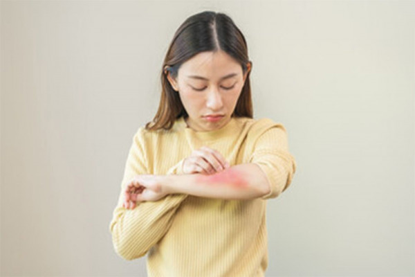 frambusia disebabkan oleh, gejala frambusia, pencegahan frambusia, obat frambusia, frambusia adalah, frambusia disease, yesdok
