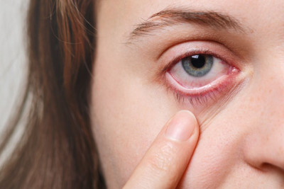 CIRI-CIRI ALAMI MATA SILINDER (ASTIGMATISME), SIMAK GEJALANYA YUK