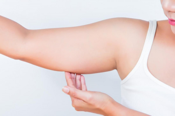 Ini Langkah Tepat Usir Lengan Bergelambir