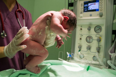 KENALI 7 PENYEBAB NEURAL TUBE DEFECT (NTD) PADA BAYI YUK 
