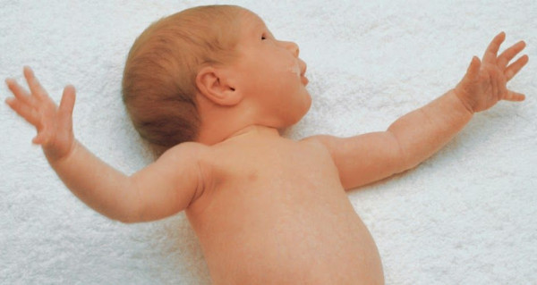 Mengenal Reflek Moro yang Bikin Bayi Kagetan
