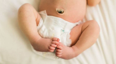 Cara Cegah Infeksi Tali Pusar Bayi