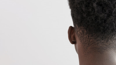 WASPADAI KULIT LEHER GELAP (ACANTHOSIS NIGRICANS) INDIKASI DIABETES