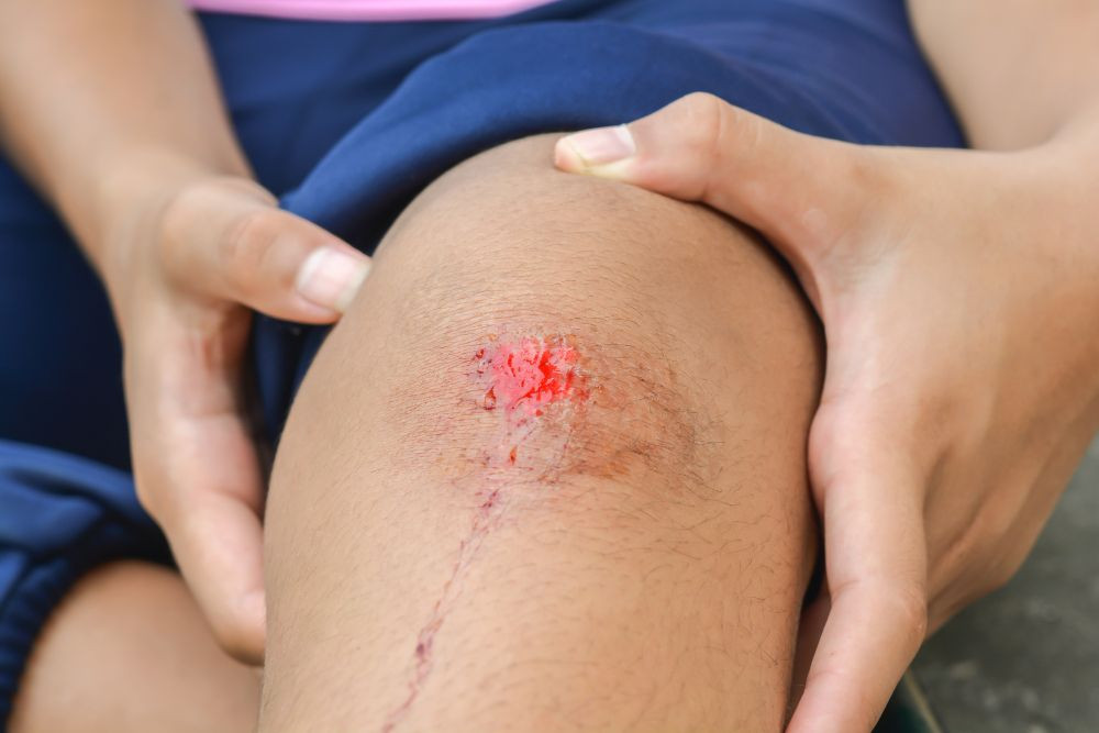 LUKA SULIT SEMBUH? INI 6 PENYEBABNYA | Yesdok.com