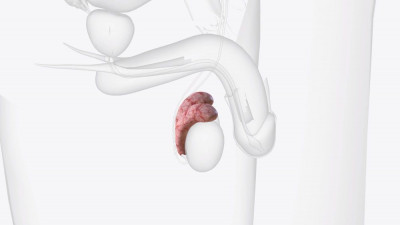 Dampak Torsio Testis Bagi Kesehatan