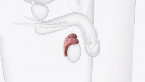 torsio testis, torsio testis adalah, apa itu torsio testis, gejala torsio testis, penyebab torsio testis, ciri ciri torsio testis, torsio testis penyebab, faktor resiko torsio testis, yesdok
