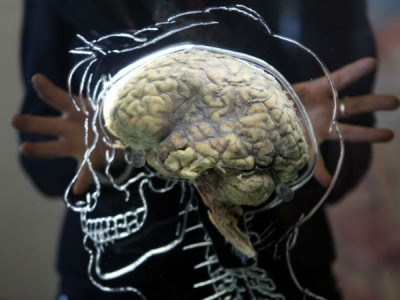 Ini yang Akan Terjadi Pada Tubuh Saat Otak Mulai Menua