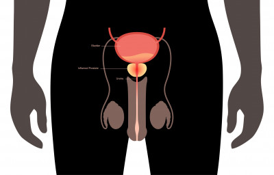 Penyebab Torsio Testis pada Pria 