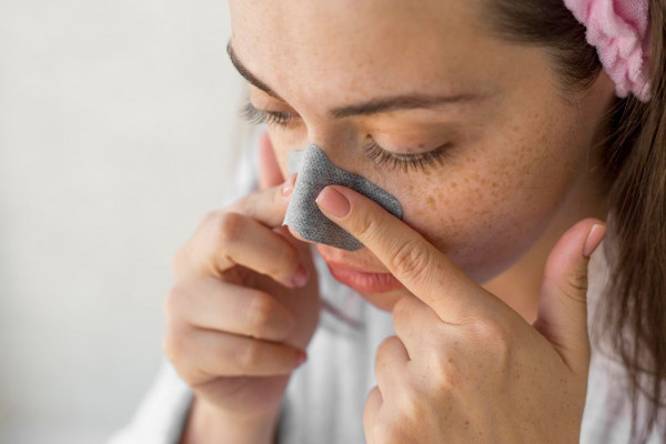 penyebab komedo, komedo di hidung, komedo putih, cara menghilangkan komedo, yesdok