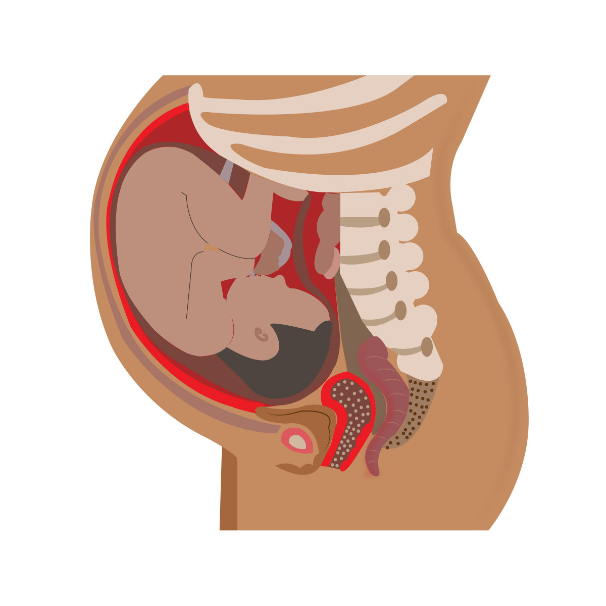 placentaaccreta, rahim, dindingrahim, melahirkan