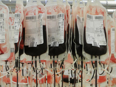 Manfaat Donor Darah Bagi Kesehatan yang Wajib Diketahui