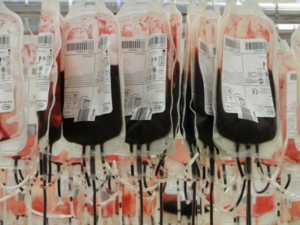 Manfaat Donor Darah Bagi Kesehatan yang Wajib Diketahui