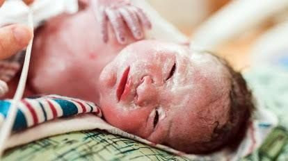 Bayi Tidak Menangis Saat Lahir, Normalkah?