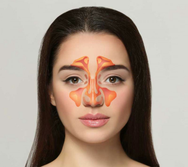 Kenali Bahaya Komplikasi Sinusitis