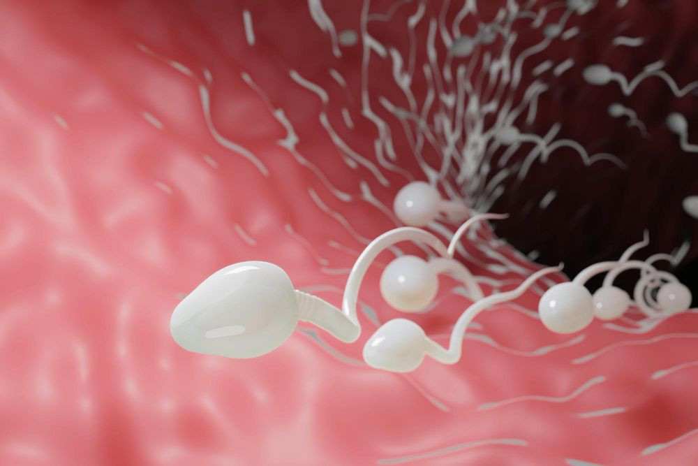 kelainan pada sperma, sperma tidak normal, sperma abnormal, bentuk sperma abnormal, hypospermia adalah, oligozoospermia artinya, arti teratozoospermia, normozoospermia, abnormal sperm, yesdok