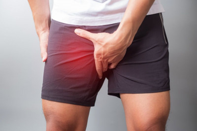 SIMAK 8 PENYEBAB VARIKOKEL (VARISES TESTIS) YUK!