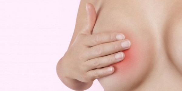 Tips Mudah Mengatasi Puting Lecet Bagi Ibu Menyusui