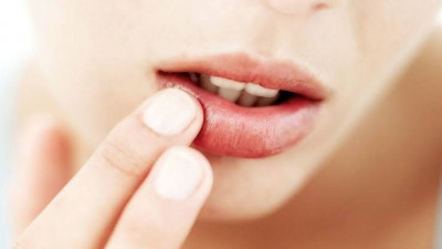 Warna Bibir Dapat Tunjukan Kondisi Tubuh Anda