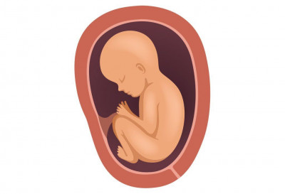 Ketahui Berbagai Posisi Bayi Dalam Kandungan yang Pengaruhi Proses Persalinan