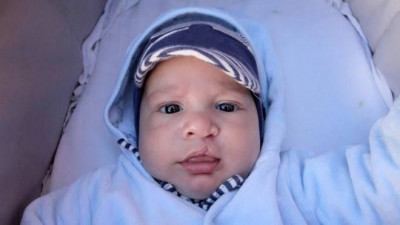 Cara Hindari Bayi Lahir Sumbing