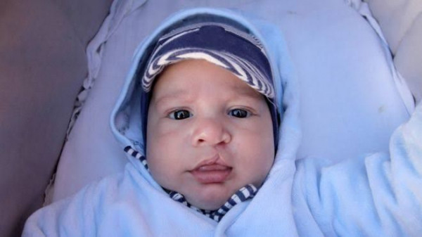 Cara Hindari Bayi Lahir Sumbing