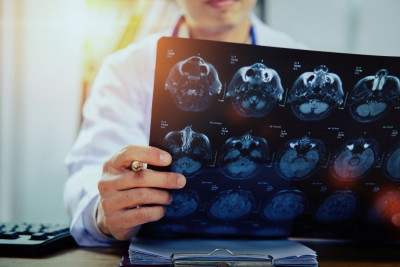 SIMAK GEJALA TUMOR OTAK, SALAH SATUNYA SERING HALU