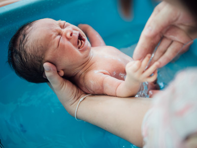 Ini Penyebab Kulit Bayi Baru Lahir Mengelupas