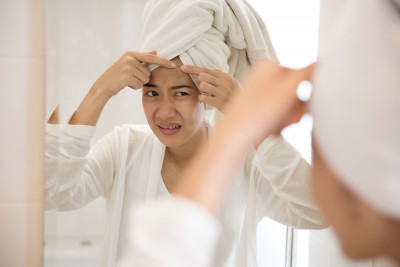 Apakah Pengobatan Alami Efektif Untuk Mengatasi Jerawat Hormonal?