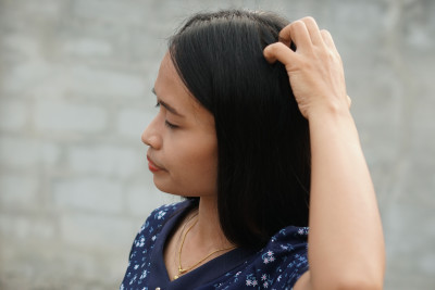 Pengobatan Rumahan Untuk Mengatasi Kulit Kepala Kering 