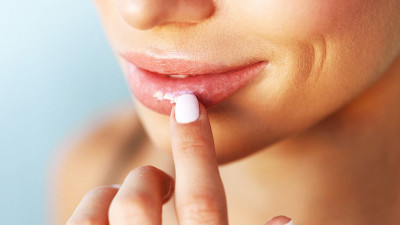 Bibir Kering saat Puasa? Ini Tipsnya!