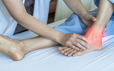 Asam Urat dapat Disebabkan Keturunan, Tapi Diperparah Gaya Hidup yang Tidak Sehat