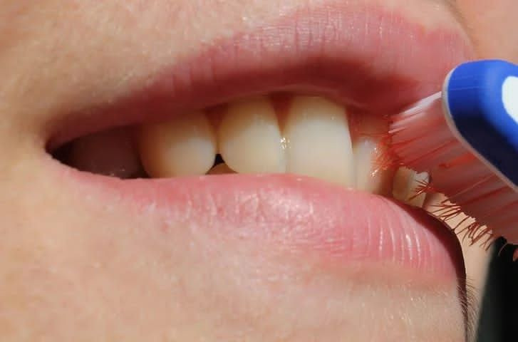 Perawatan gigi 
