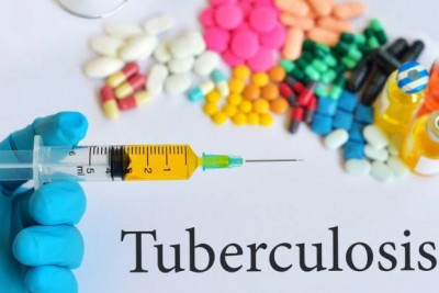 Waspada Tuberkulosis Resisten Obat di Masa Pandemi