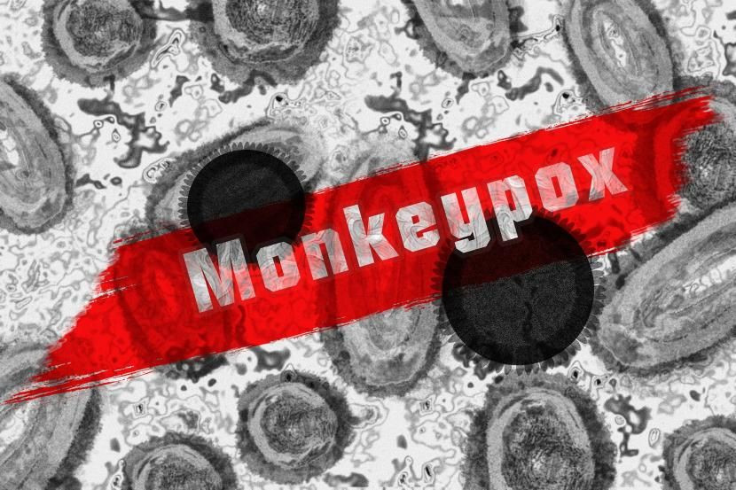 ilustrasi monkeypox